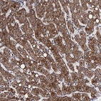 Anti-VPS37D Antibody