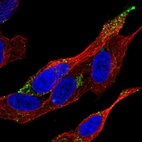 Anti-VPS37D Antibody