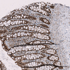 Anti-RMI2 Antibody