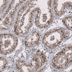 Anti-RMI2 Antibody