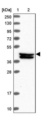 Lane 1: Marker [kDa] 250, 130, 95, 72, 55, 36, 28, 17, 10_br/_Lane 2: Human cell line RT-4