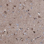 Anti-C1QTNF4 Antibody