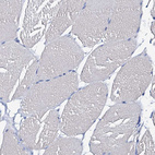 Anti-CSN2 Antibody