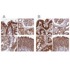 Anti-MKKS Antibody