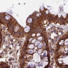 Anti-MKKS Antibody