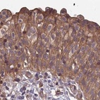 Anti-MKKS Antibody