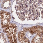 Anti-MKKS Antibody