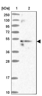 Anti-MKKS Antibody