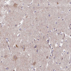 Anti-WDR59 Antibody