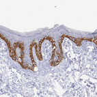 Anti-PLA2G4E Antibody