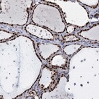 Anti-TSEN34 Antibody