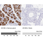 Anti-ZG16B Antibody