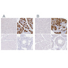 Anti-ZG16B Antibody