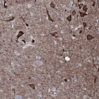 Anti-WIPF3 Antibody