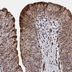 Anti-GDPD3 Antibody