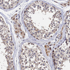 Anti-ANKEF1 Antibody