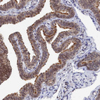 Anti-ANKEF1 Antibody