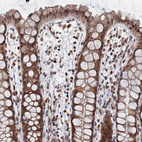 Anti-ANKEF1 Antibody