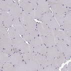 Anti-ANKEF1 Antibody