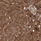 Anti-RSAD2 Antibody