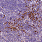 Anti-ENKD1 Antibody