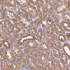 Anti-TIMM8B Antibody