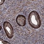 Anti-TXNDC11 Antibody