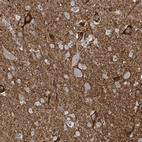 Anti-WIPF3 Antibody