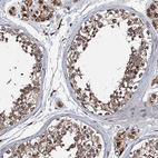 Anti-NDUFA13 Antibody