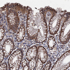 Anti-NDUFA13 Antibody