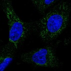 Anti-NDUFA13 Antibody