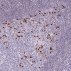 Anti-ZBP1 Antibody