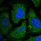 Anti-EIF2S2 Antibody