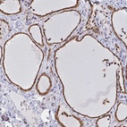 Immunohistochemical staining of human thyroid gland shows high expression.