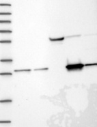 Anti-NIT2 Antibody