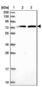 Anti-KBTBD8 Antibody