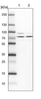 Anti-KBTBD8 Antibody