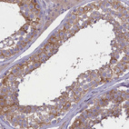 Anti-CORO2A Antibody