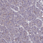 Anti-CORO2A Antibody