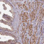 Immunohistochemical staining of human prostate shows moderate cytoplasmic positivity in smooth muscle cells and weak membranous staining of glandular cells.