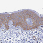 Immunohistochemical staining of human skin shows weak cytoplasmic positivity in squamous epithelial cells.