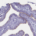 Immunohistochemical staining of human fallopian tube shows strong cytoplasmic positivity in cilium basal body in glandular cells.