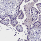 Immunohistochemical staining of human placenta no positivity in trophoblastic cells as expected.