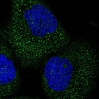 Anti-TELO2 Antibody