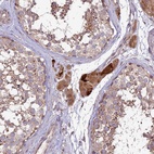 Anti-COG8 Antibody