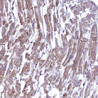 Anti-ANKS3 Antibody