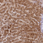 Anti-ANKS3 Antibody