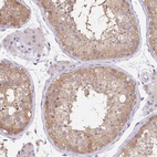 Anti-DNAJC5G Antibody