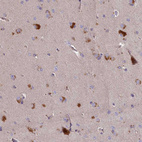 Anti-PLEKHG6 Antibody