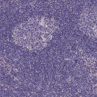 Anti-PLEKHG6 Antibody